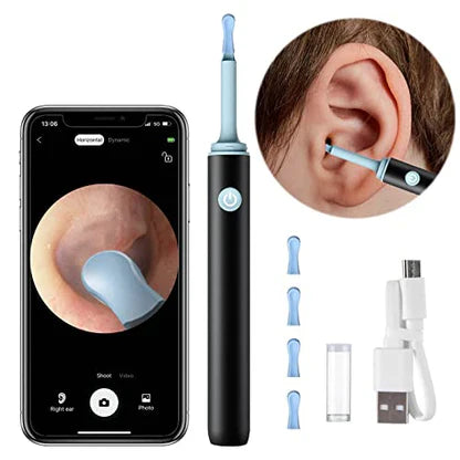 AVANTI™  - PROFESSIONAL EAR WAX REMOVAL TOOL